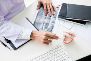 歯の模型とレントゲンで説明している歯科医師