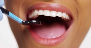 歯鏡で口内を診察している女性の口元
