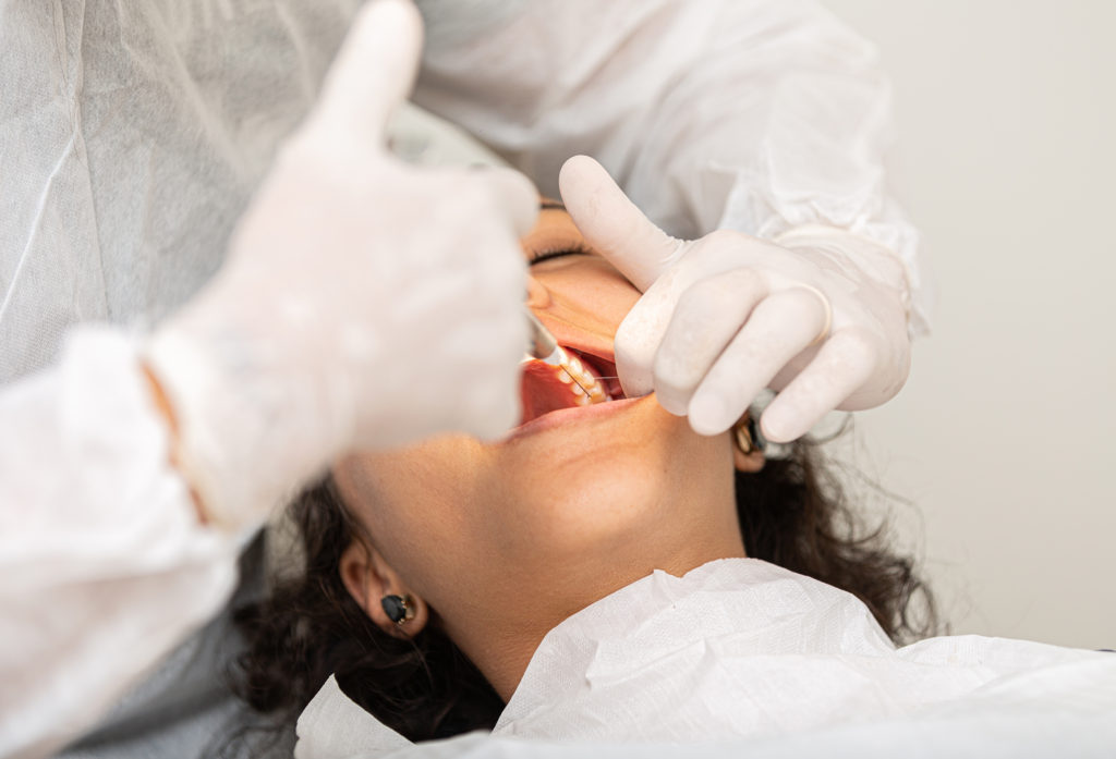 歯科で口を大きく開けて治療を受けている女性